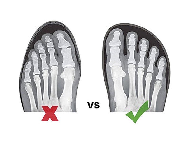 BAREFOOT: a shift in footwear design philosophy?